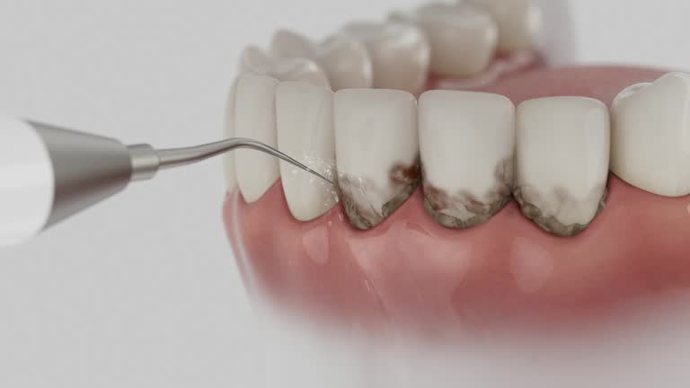 Reliable Teeth Cleaning And Checkup contractor in Sharkey County County, MS by Dentist Open Now